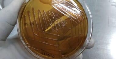Découverte révolutionnaire : le microbiome intestinal et la dépression