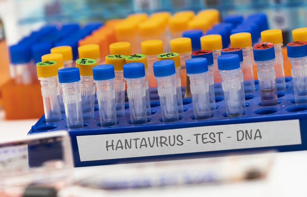 Hantavirus : la désinformation massive sur les réseaux sociaux réactive les théories du complot